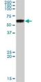 Glucosylceramidase Beta antibody, H00002629-B01P, Novus Biologicals, Western Blot image 