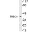 Tribbles Pseudokinase 3 antibody, LS-C200030, Lifespan Biosciences, Western Blot image 