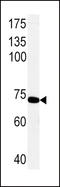 Phosphoenolpyruvate Carboxykinase 1 antibody, LS-C101194, Lifespan Biosciences, Western Blot image 