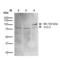 Potassium Voltage-Gated Channel Subfamily C Member 2 antibody, LS-C774280, Lifespan Biosciences, Western Blot image 