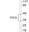 Collagen Like Tail Subunit Of Asymmetric Acetylcholinesterase antibody, A03301, Boster Biological Technology, Western Blot image 