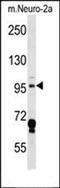 Eukaryotic Elongation Factor 2 Kinase antibody, orb224155, Biorbyt, Western Blot image 