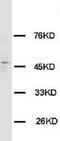 Histamine Receptor H3 antibody, LS-C171946, Lifespan Biosciences, Western Blot image 