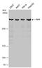 Telomere-associated protein RIF1 antibody, GTX131787, GeneTex, Western Blot image 