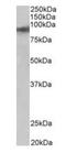 Zinc Finger Protein 652 antibody, orb125233, Biorbyt, Western Blot image 
