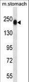 Tenascin N antibody, LS-C160093, Lifespan Biosciences, Western Blot image 