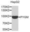 Glycogen Phosphorylase, Muscle Associated antibody, orb374236, Biorbyt, Western Blot image 