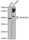 TNF Receptor Superfamily Member 10d antibody, LS-C749091, Lifespan Biosciences, Western Blot image 