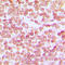 POU Class 2 Homeobox 1 antibody, LS-C352692, Lifespan Biosciences, Immunohistochemistry paraffin image 