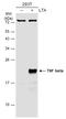 Lymphotoxin Alpha antibody, GTX130100, GeneTex, Western Blot image 