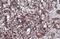 Cytochrome C Oxidase Subunit 4I1 antibody, GTX114330, GeneTex, Immunohistochemistry paraffin image 