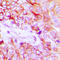 Erb-B2 Receptor Tyrosine Kinase 4 antibody, GTX32389, GeneTex, Immunohistochemistry paraffin image 