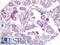 Distal-Less Homeobox 2 antibody, LS-A11271, Lifespan Biosciences, Immunohistochemistry paraffin image 