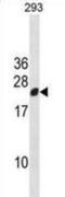 Regulator Of G Protein Signaling 13 antibody, abx031022, Abbexa, Western Blot image 