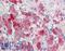 Ectodermal-Neural Cortex 1 antibody, LS-B9563, Lifespan Biosciences, Immunohistochemistry paraffin image 