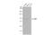 Hedgehog Interacting Protein antibody, GTX112584, GeneTex, Western Blot image 