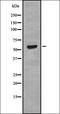 Solute Carrier Family 22 Member 6 antibody, orb337378, Biorbyt, Western Blot image 