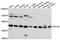 Adaptor Related Protein Complex 1 Subunit Mu 1 antibody, A10129, ABclonal Technology, Western Blot image 