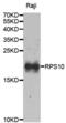 Ribosomal Protein S10 antibody, PA5-76892, Invitrogen Antibodies, Western Blot image 