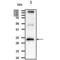 Phosphoserine Phosphatase antibody, NBP1-04297, Novus Biologicals, Western Blot image 