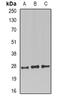 PRP antibody, abx141693, Abbexa, Western Blot image 