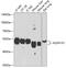 Aldehyde Dehydrogenase 1 Family Member A1 antibody, GTX32431, GeneTex, Western Blot image 