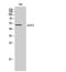 Acyl-CoA Thioesterase 2 antibody, A10261-1, Boster Biological Technology, Western Blot image 