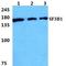 Splicing Factor 3b Subunit 1 antibody, GTX66743, GeneTex, Western Blot image 