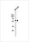 Dihydropyrimidinase antibody, PA5-49411, Invitrogen Antibodies, Western Blot image 