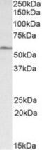 Glucagon-like peptide 1 receptor antibody, MBS423129, MyBioSource, Western Blot image 