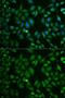 Secretogranin II antibody, GTX54665, GeneTex, Immunofluorescence image 