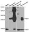 Hemoglobin Subunit Alpha 2 antibody, abx007141, Abbexa, Western Blot image 