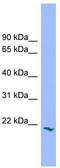 Proline Rich And Gla Domain 2 antibody, TA335272, Origene, Western Blot image 