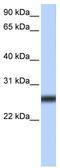 Transmembrane Serine Protease 5 antibody, TA339557, Origene, Western Blot image 