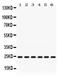 RAB5A, Member RAS Oncogene Family antibody, PB9787, Boster Biological Technology, Western Blot image 