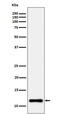 NADH:Ubiquinone Oxidoreductase Subunit C2 antibody, M09084, Boster Biological Technology, Western Blot image 