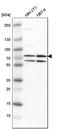 Protein arginine N-methyltransferase 5 antibody, HPA005525, Atlas Antibodies, Western Blot image 