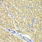 Glutaredoxin 3 antibody, LS-C334368, Lifespan Biosciences, Immunohistochemistry paraffin image 