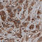 Cysteinyl-TRNA Synthetase antibody, AMAb90972, Atlas Antibodies, Immunohistochemistry paraffin image 