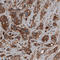 Cysteinyl-tRNA synthetase, cytoplasmic antibody, AMAb90972, Atlas Antibodies, Immunohistochemistry paraffin image 