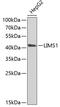LIM Zinc Finger Domain Containing 1 antibody, 22-176, ProSci, Western Blot image 