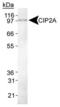 Cell Proliferation Regulating Inhibitor Of Protein Phosphatase 2A antibody, MA1-46001, Invitrogen Antibodies, Western Blot image 