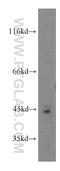 ArfGAP With Dual PH Domains 2 antibody, 13706-1-AP, Proteintech Group, Western Blot image 