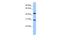 TUB Like Protein 3 antibody, A09384, Boster Biological Technology, Western Blot image 