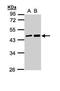 Melanoma-associated antigen 11 antibody, PA5-22114, Invitrogen Antibodies, Western Blot image 