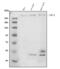 Neurofibromin 1 antibody, M00043, Boster Biological Technology, Western Blot image 