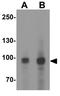 MALT1 Paracaspase antibody, GTX31609, GeneTex, Western Blot image 