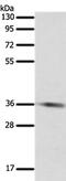 Sulfotransferase Family 1E Member 1 antibody, PA5-50274, Invitrogen Antibodies, Western Blot image 
