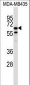 Tripartite Motif Containing 39 antibody, LS-C160193, Lifespan Biosciences, Western Blot image 