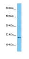 Testis Expressed 19 antibody, orb326062, Biorbyt, Western Blot image 